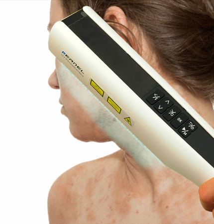 Zakup lampy do fototerapii w warunkach domowych Kernel UVB 311nm KN-4003BL2D (bezprzewodowa)