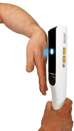 Zakup lampy do fototerapii w warunkach domowych Kernel UVB 311nm KN-4003BL2D (bezprzewodowa)