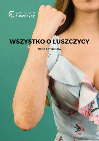 Ebook "Wszystko o łuszczycy" zbiór artykułów