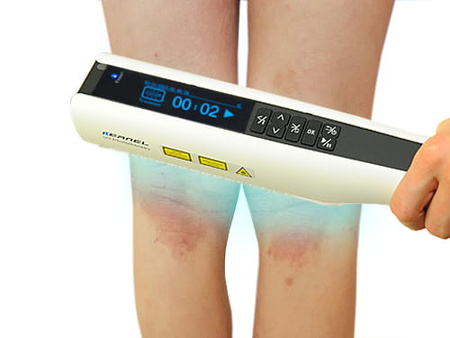 Zakup lampy do fototerapii w warunkach domowych Kernel UVB 311nm KN-4003BL2D (bezprzewodowa)