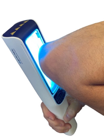 Zakup lampy do fototerapii w warunkach domowych Kernel UVB 311nm KN-4003BL2D (bezprzewodowa)