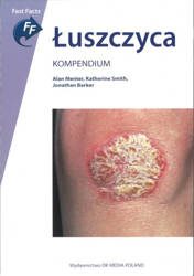 Łuszczyca. Kompendium.  Alan Menter, Jonathan Barker, Smith Katherine