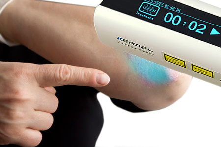 Zakup lampy do fototerapii w warunkach domowych Kernel UVB 311nm KN-4003BL2D (bezprzewodowa)